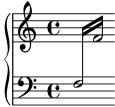 [image of music]